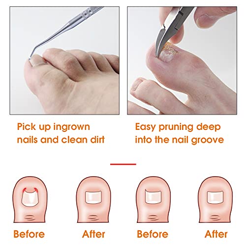 MAYCREATE® Ingrown Toenail Clippers for Thick Toenails Wide Jaw Opening Nail Curved and Slant Straight Blade Edge 12PCS Stainless Steel Toe Clipper Men MAYCREATE® Ingrown Toenail Clippers for Thick Toenails Wide Jaw Opening Nail Curved and Slant Straight Blade Edge 12PCS Stainless Steel Toe Clipper Men